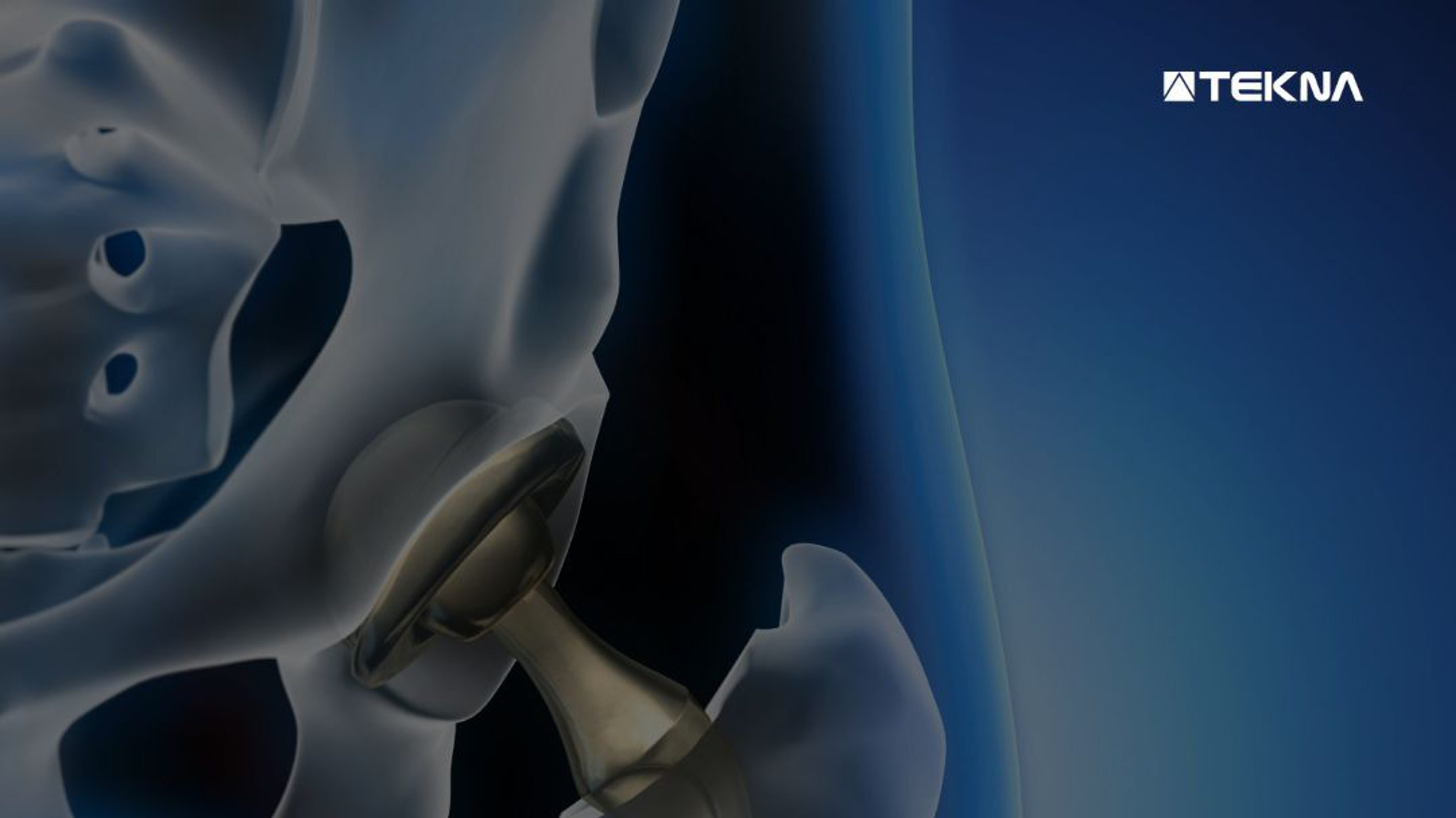 TEKNA’s Advanced Materials division meets the highest global standards ...